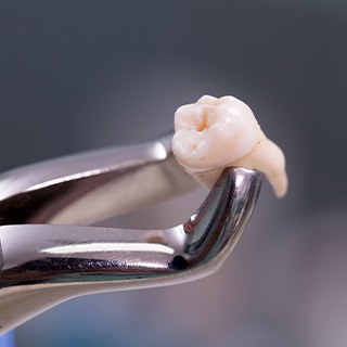 Dental forceps holding an extracted tooth