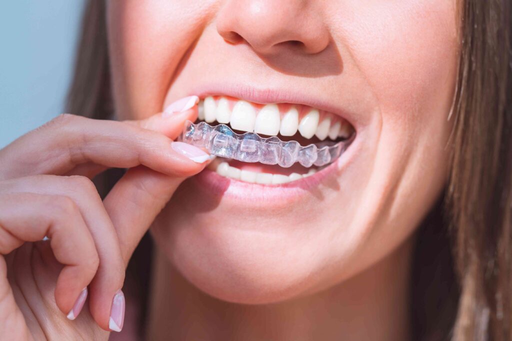 Woman putting in her retainer